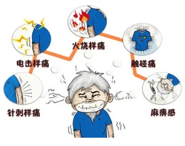 牙疼久治不愈、脸抽筋，你真的看对病了吗! ? 微血管减压术“一招制敌”！(图1)