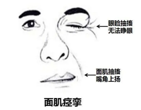 牙疼久治不愈、脸抽筋，你真的看对病了吗! ? 微血管减压术“一招制敌”！(图2)