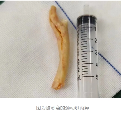 卒中中心团队通力协作，为患者畅通大脑“生命线”(图2)